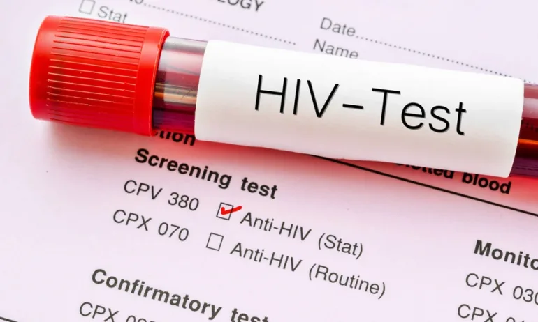 Безплатни прегледи за ХИВ и СПИН в Пазарджик - Tribune.bg