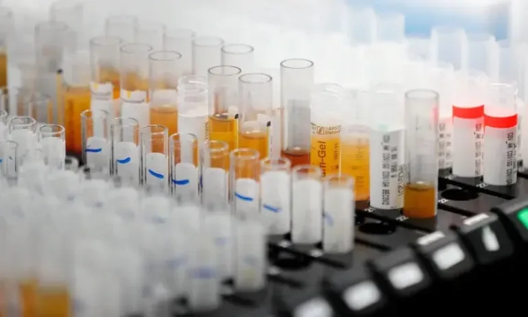 В НЦЗПБ чрез целогеномно секвениране са анализирани 332 клинични проби със