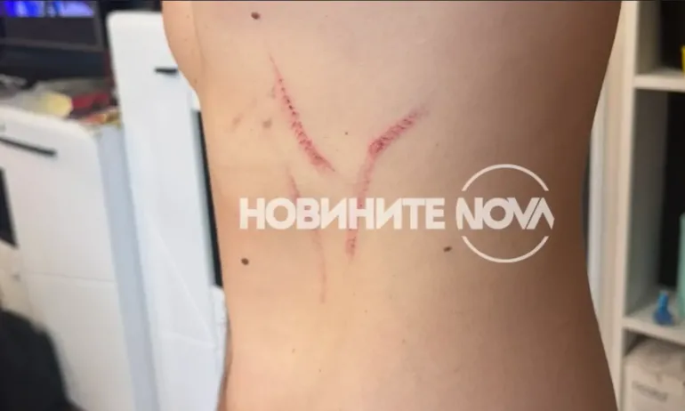 Единият полицай показа травмите си от Явор Георгиев: Клипът в мрежата е силно редактиран - Tribune.bg