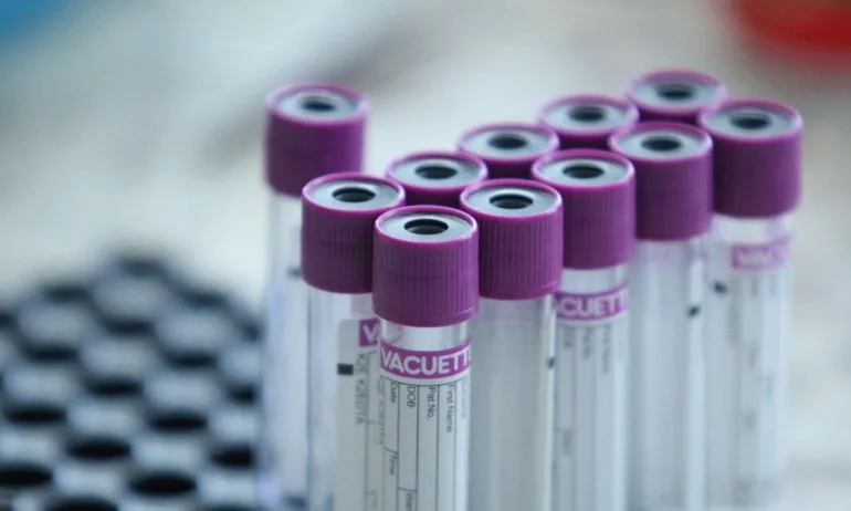 1990 са потвърдените случаи на COVID-19 у нас - Tribune.bg