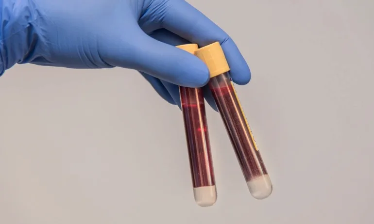 Разбиха схема за издаване на фалшиви PCR тестове в Харманли - Tribune.bg