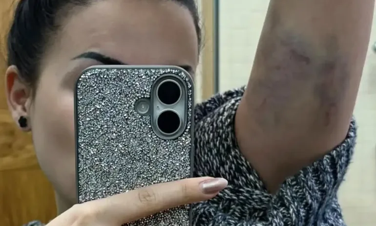 Млада жена твърди, че е жертва на полицейски произвол и последвало насилие - Tribune.bg