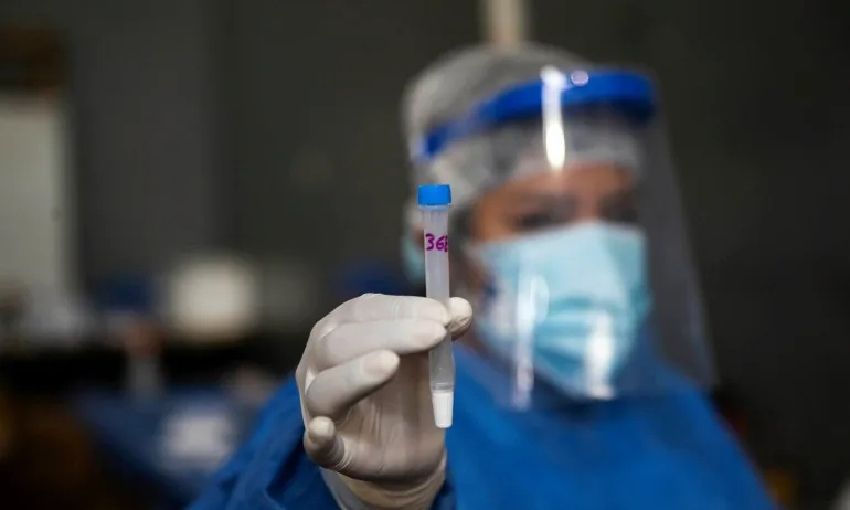 3159 нови случая на заразени с COVID-19, положителни са 18,4% от тестовете - Tribune.bg