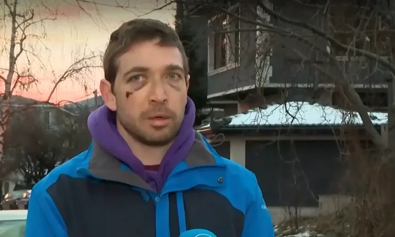 Със заплахи за убийство - пребиха мъж пред бременната му жена след забележка на пътя - Tribune.bg