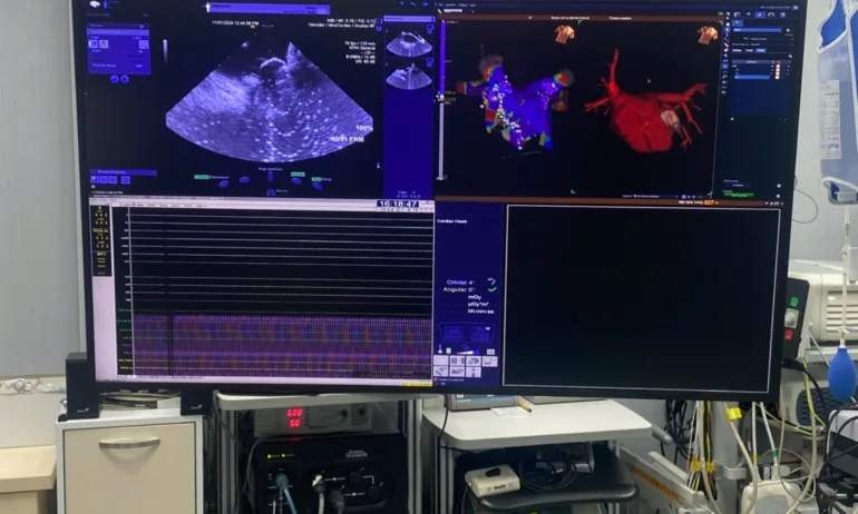 За първи път в България в УМБАЛ Св. Анна бе направена Kриоаблация на белодробни вени без рентгеново облъчване - Tribune.bg