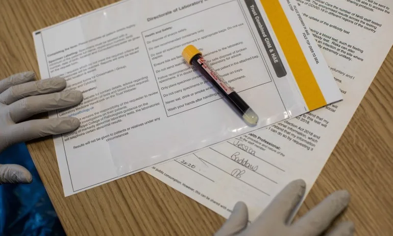 48 са общо заразените с коронавирус в Сърница - Tribune.bg