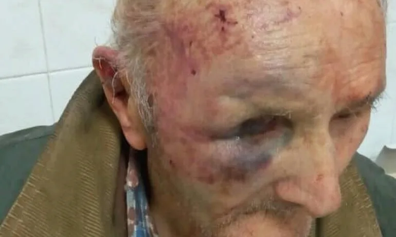 За 120 лева - Мъж преби жестоко 82-годишен дядо - Tribune.bg
