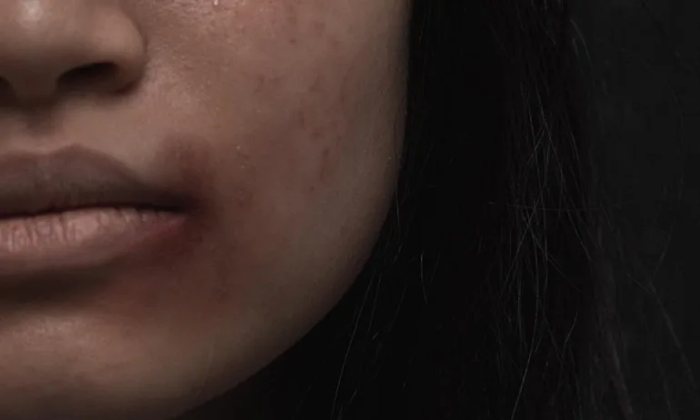 Всяка трета европейка е била жертва на физическо и сексуално насилие, българките - най-рядко - Tribune.bg