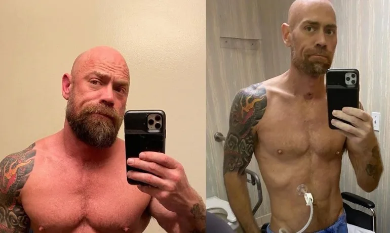 Преди и след COVID-19 – американец показа снимка - Tribune.bg