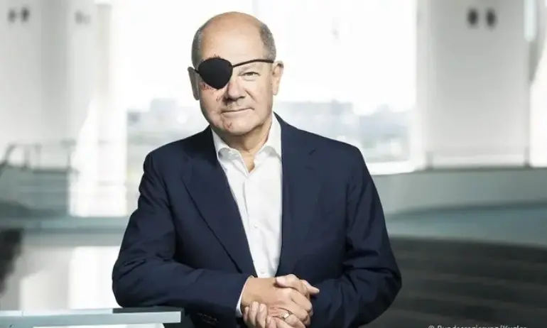 Канцлерът Шолц пострада след джогинг. Шегите и колажите за вида му не закъсняха…/СНИМКИ/ - Tribune.bg