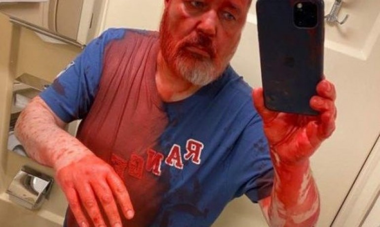 Заляха с червена боя главния редактор на Новая газета - Tribune.bg