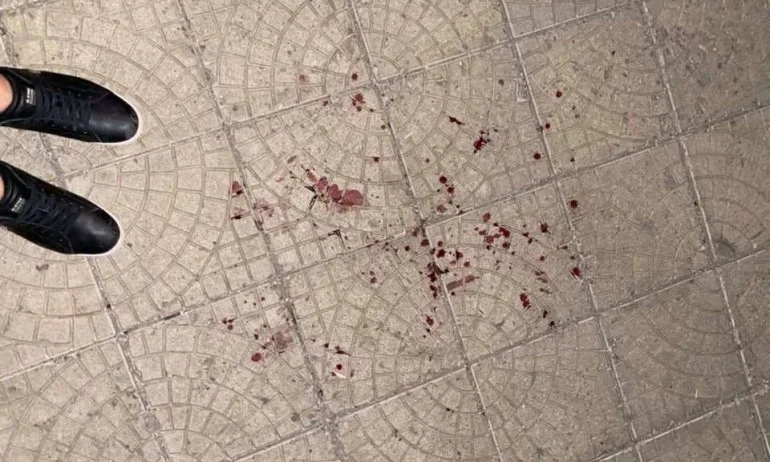 Битият Флоров разпространи снимки след нападението - Tribune.bg