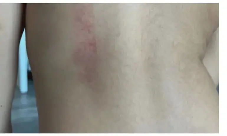 4-годишно дете със синини след детска градина - Tribune.bg