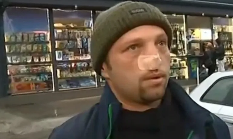 След скандал на пътя – мъж е с отхапан нос - Tribune.bg