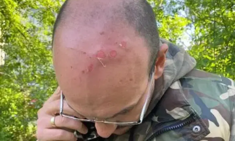 Снимка: Журналистът Димитър Стоянов нападнал и наранил служител на НАП