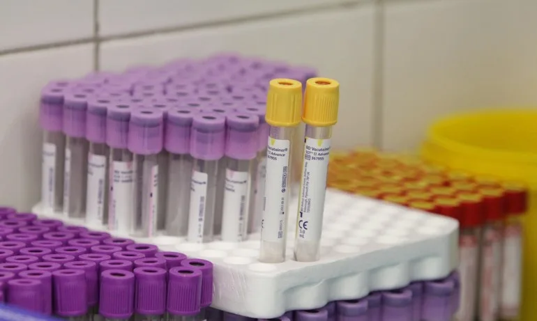 623 са новите случаи на коронавирус у нас - Tribune.bg