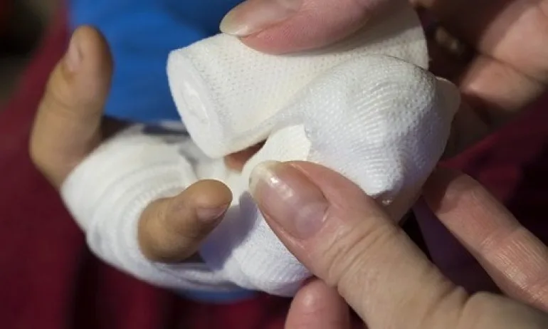 Мобилно приложениe ни учи как да реагираме при изгаряния - Tribune.bg