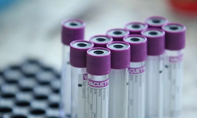 Бързите тестове за COVID-19 на завърналите се от кланица в Германия българи са отрицателни - Tribune.bg