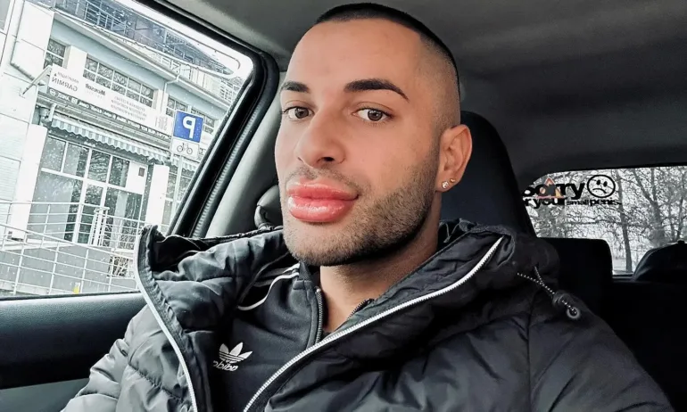 Заради хиалурона в устните: Младежи нападнаха щангиста Захари Георгиев - Tribune.bg