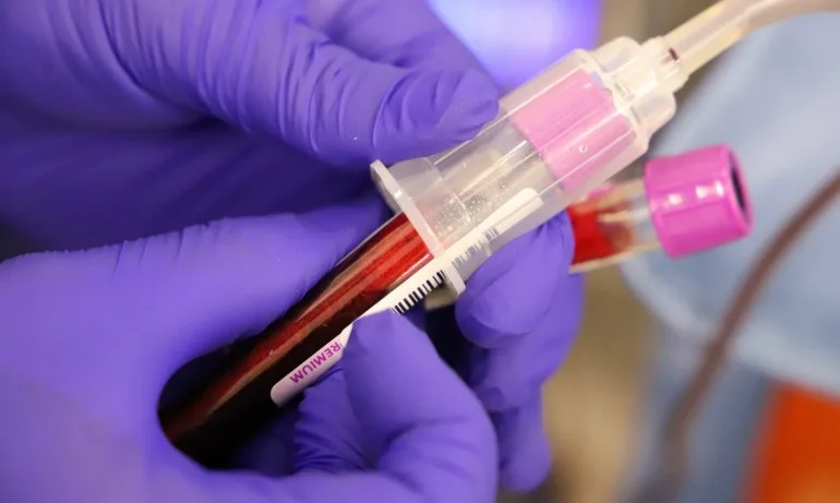 Кръвният център във Варна вече набира желаещи да дарят плазма - Tribune.bg