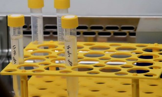 5 положителни тестове и нови 838 случая на заразени с