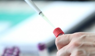 СЗО е открила над 90 заболели в 12 страниПърви предполагаем