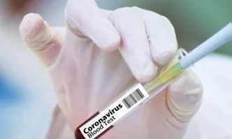 12 нови случая на COVID-19 у нас, общо заразените са 1399