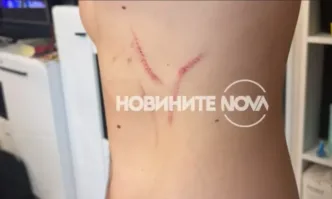 Единият полицай показа травмите си от Явор Георгиев: Клипът в мрежата е силно редактиран