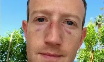 Марк Зукърбърг се похвали в Instagram с две насинени очи