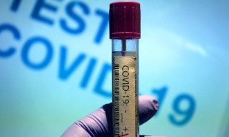 Над 1300 нови случаи на коронавирус, 44 души са починали