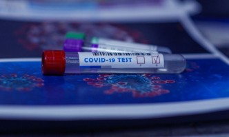 532 са новите случаи на коронавирус в България при направени