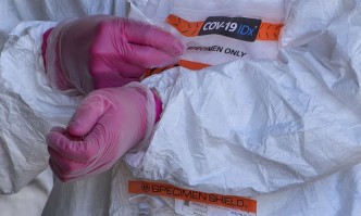 Covid: 157 пациенти са изгубили битката с вируса за денонощието