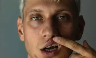 Получих множество удари по тялото главата и тила Усетих душене