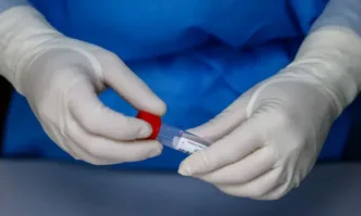 Новите случаи на коронавирус у нас за последното денонощие са