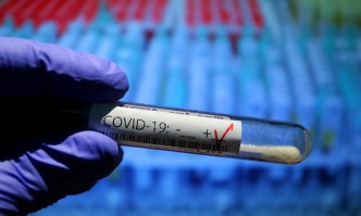 Над 1600 нови случаи на коронавирус, 81 души са починали