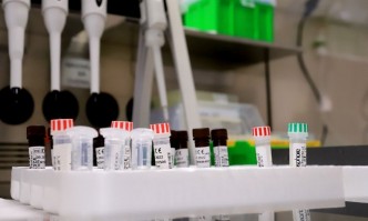 След отпадане на епидемичната обстановка: Хаос с направленията за PCR тестове