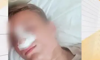 Жесток побой над трима тийнейджъри на 15 години в Айтос