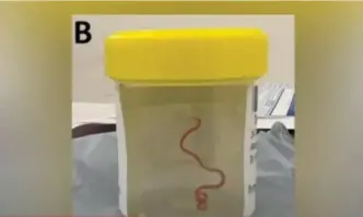 За първи път в света учените са открили жив червей