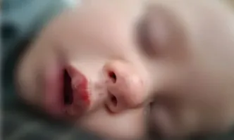 Майката на блъснатото от тротинетка дете: Страшно травмирано е и не спира да плаче