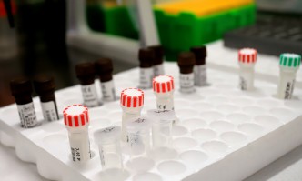 10 151 са новите случаи на коронавирус у нас през