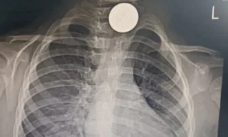 Родителите се успокояват и няколко седмици Мелиса ходи на ясла