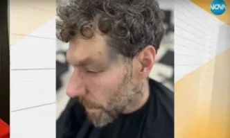 Двама мъже известен фризьор и неговият приятел са пребити