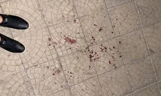 Битият Флоров разпространи снимки след нападението