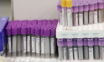 4 737 са новите случаи на коронавирус според данните на