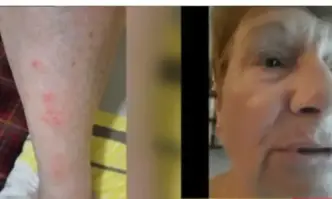 Тя споделя че може да се наложи нейна приятелка да