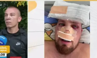 Двама братя са в болница със счупени носове и зъби