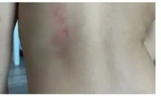 4 годишно момиченце е със синини след детска градина Случаят е от