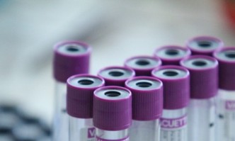 От днес в болниците в Мадрид ще започнат тестове за