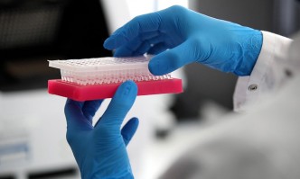 Въпреки че Аржентина е страната с най високи нива на заболяваемост