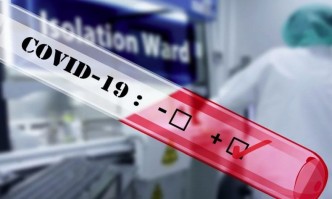 За последното денонощие у нас са регистрирани 724 нови случая